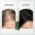 Root-Strengthening  Hair Growth Essence (15ml)  | Unisex-Rosemary